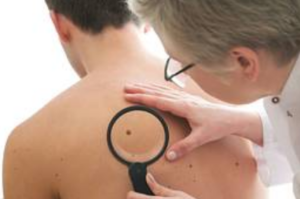 Birthmarks Reveal About Your Past Lives