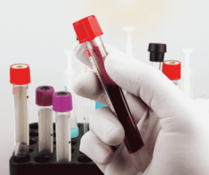 A gloved hand holds a blood sample tube near laboratory vials.