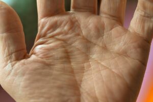 an open human palm and fingers against a plain dark background, clearly showing the lines and texture of the skin