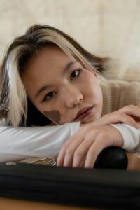 woman with birthmark on the face